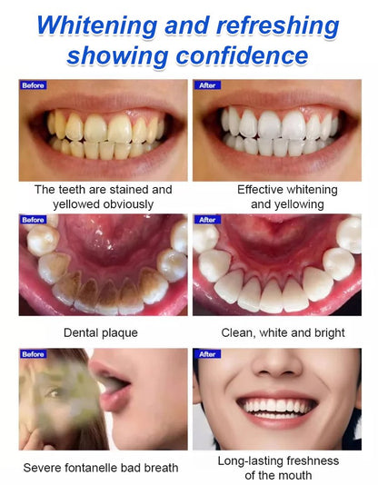 🦷BBOJI Teeth Whitening Gel  Colour Corrector