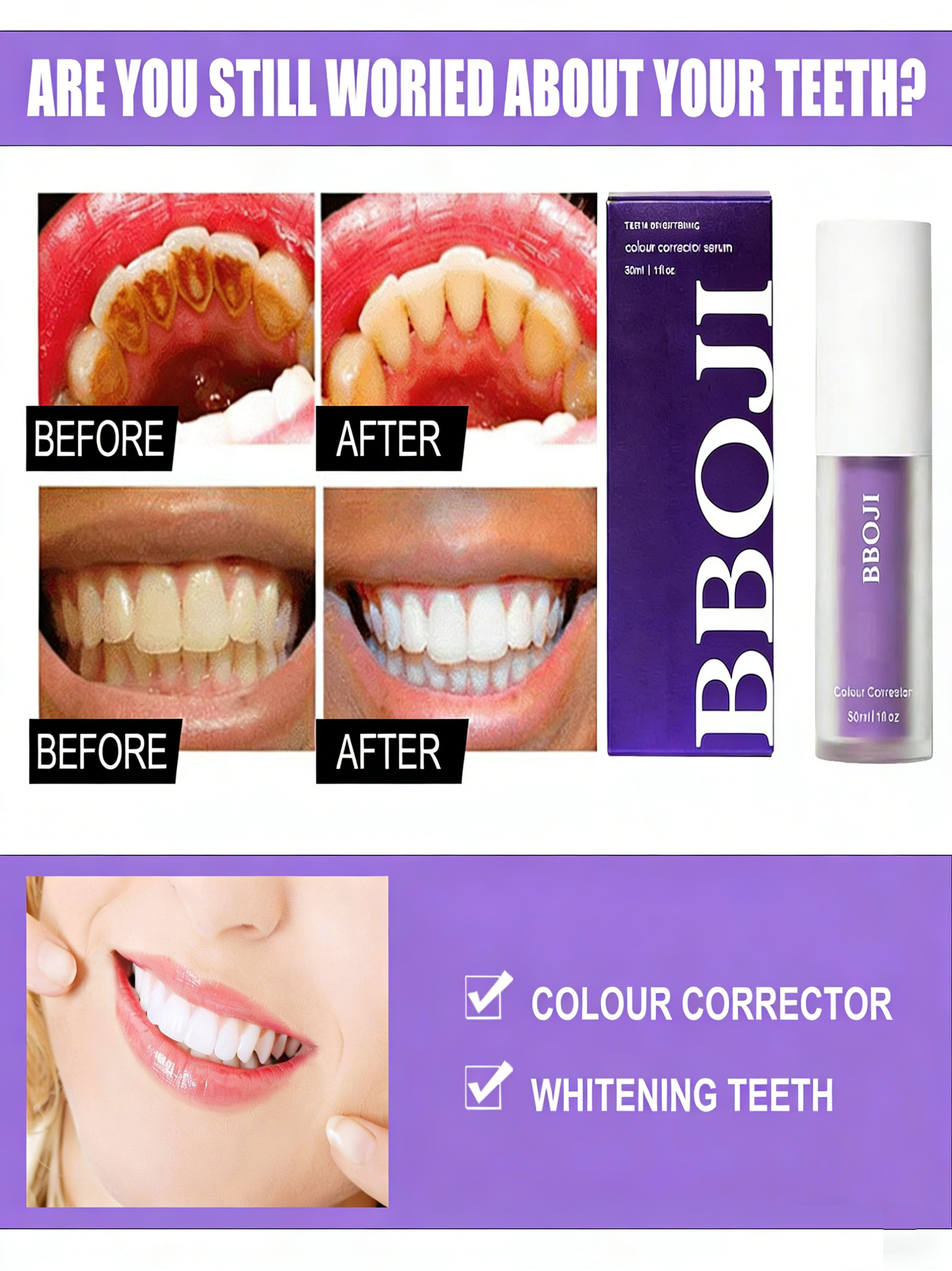 🦷BBOJI Teeth Whitening Gel  Colour Corrector